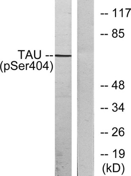 Tau (phospho Ser404) rabbit pAb
