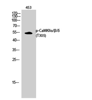 CaMKII alpha/beta/delta (phospho-Thr305) antibody