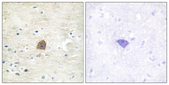 CaMKIIα/β/δ (phospho Thr305) rabbit pAb