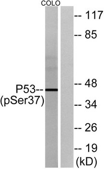 p53 (phospho-Ser37) antibody