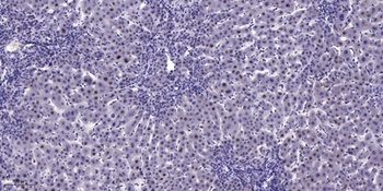 p53 (phospho-Ser37) antibody