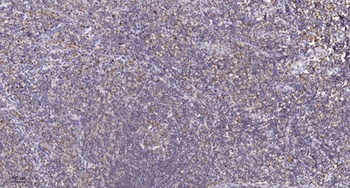 p27 (phospho-Thr187) antibody