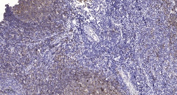 c-Src (phospho-Tyr419) antibody