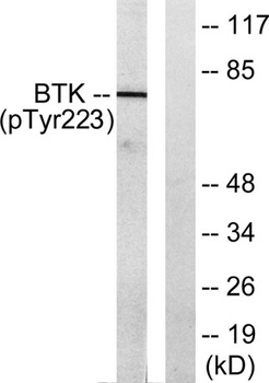 Btk (phospho Tyr223) rabbit pAb