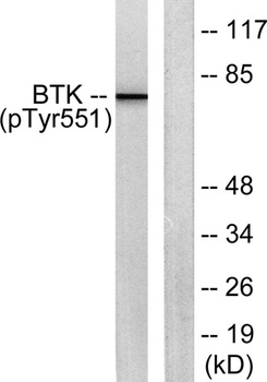 Btk (phospho Tyr551) rabbit pAb