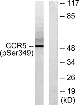 CKR-5 (phospho-Ser349) antibody