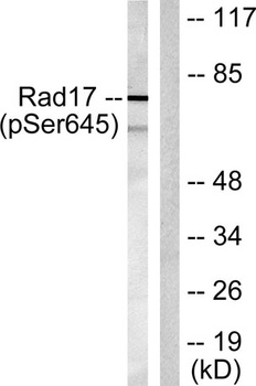 Rad17 (phospho Ser645) rabbit pAb
