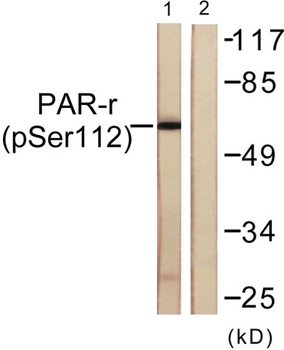 PPAR-gamma (phospho-Ser112) antibody