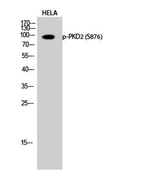 PKD2 (phospho-Ser876) antibody