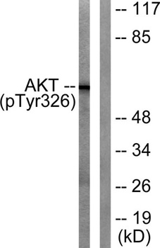 Akt (phospho Tyr326) rabbit pAb