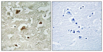 Smad3 (phospho Ser204) rabbit pAb