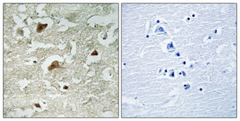 Smad3 (phospho-Ser204) antibody