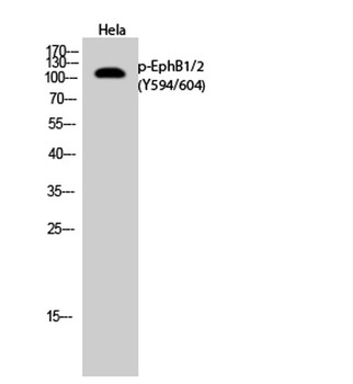 EphB1/2 (phospho Tyr594/604) rabbit pAb
