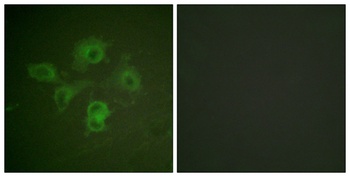 EphB1/2 (phospho-Tyr594/604) antibody