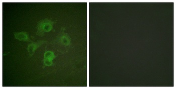 EphB1/2 (phospho Tyr594/604) rabbit pAb