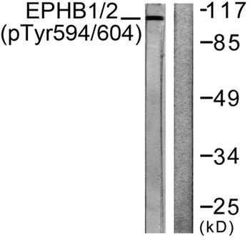 EphB1/2 (phospho Tyr594/604) rabbit pAb