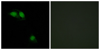 IRS-1 (phospho Ser312) rabbit pAb