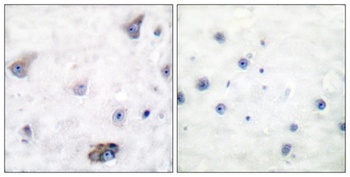 GABAA Rbeta1 (phospho-Ser434) antibody