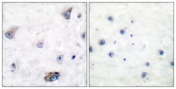 GABAA Rβ1 (phospho Ser434) rabbit pAb