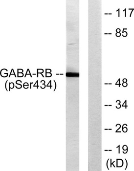 GABAA Rβ1 (phospho Ser434) rabbit pAb