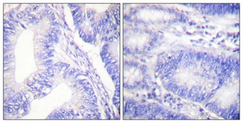 Shc (phospho Tyr427) rabbit pAb