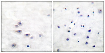 Shc (phospho Tyr427) rabbit pAb