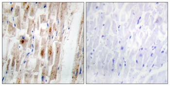 Smad1 (phospho Ser465) rabbit pAb