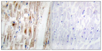 Smad1 (phospho-Ser465) antibody