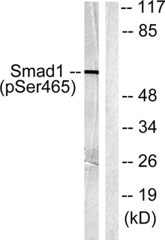 Smad1 (phospho Ser465) rabbit pAb