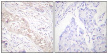 Smad2 (phospho Ser467) rabbit pAb