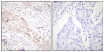 Smad2 (phospho-Ser467) antibody