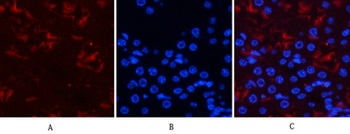 Smad3 (phospho Ser425) rabbit pAb