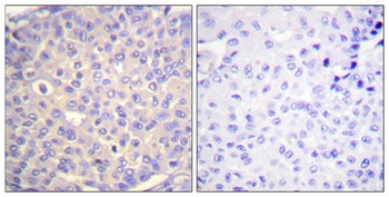 Synaptotagmin 1/2 (phospho Ser309/306) rabbit pAb
