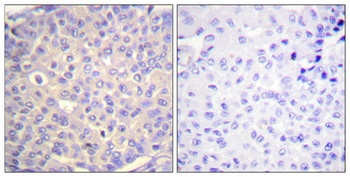 Synaptotagmin 1/2 (phospho-Ser309/306) antibody