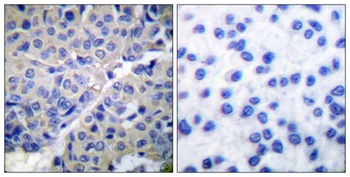Synaptotagmin 1/2 (phospho Ser309/306) rabbit pAb