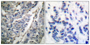 Synaptotagmin 1/2 (phospho Thr202/199) rabbit pAb