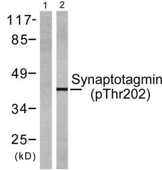 Synaptotagmin 1/2 (phospho Thr202/199) rabbit pAb