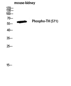 TH (phospho Ser71) rabbit pAb