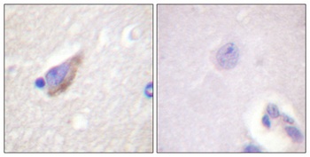 TH (phospho-Ser71) antibody