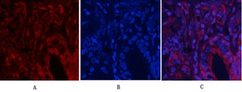 Akt (phospho Thr308) rabbit pAb
