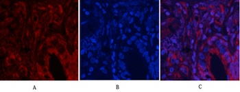 Akt (phospho-Thr308) antibody