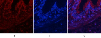 Akt (phospho Thr308) rabbit pAb