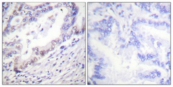 Cdk2/Cdc2 (phospho-Thr160) antibody