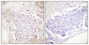 NF kappa B-p105/p50 (phospho-Ser337) antibody