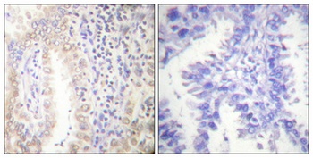 C/EBP α (phospho Ser21) rabbit pAb Antibody
