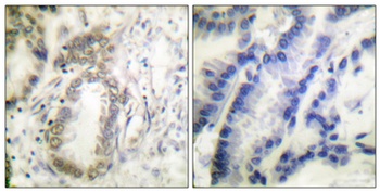 C/EBP α (phospho Ser21) rabbit pAb Antibody
