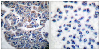 eEF2K (phospho-Ser366) antibody