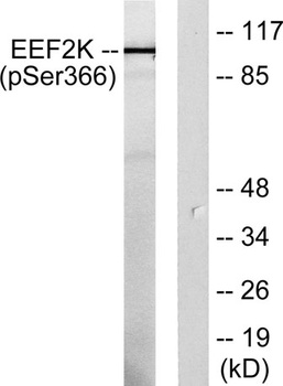 eEF2K (phospho-Ser366) antibody