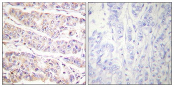 Filamin 1 (phospho Ser2152) rabbit pAb