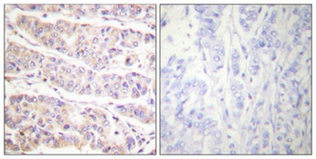 Filamin 1 (phospho-Ser2152) antibody